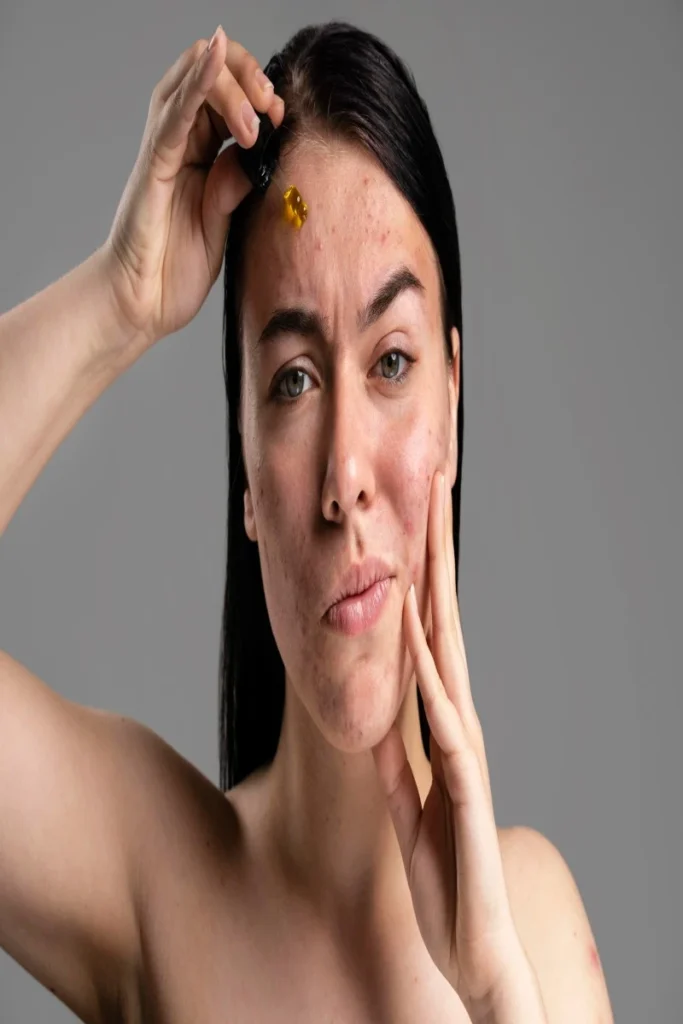A woman showing scars on her own face